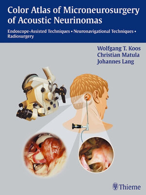 cover image of Color Atlas of Microsurgery of Acoustic Neurinomas